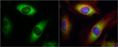 Immunocytochemistry/ Immunofluorescence - Anti-RPL17 antibody (AB155781)