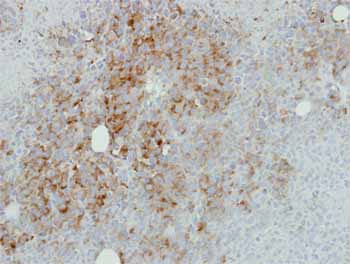 Immunohistochemistry (Formalin/PFA-fixed paraffin-embedded sections) - Anti-RPL17 antibody (AB155781)