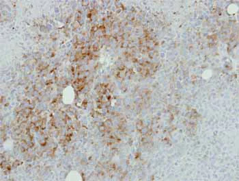 Immunohistochemistry (Formalin/PFA-fixed paraffin-embedded sections) - Anti-RPL17 antibody (AB155781)