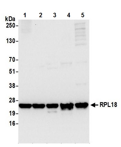Western blot - Anti-RPL18 antibody (AB241988)