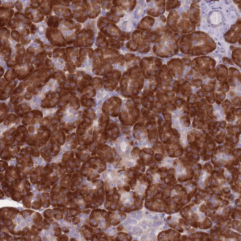 Immunohistochemistry (Formalin/PFA-fixed paraffin-embedded sections) - Anti-RPL18 antibody (AB254898)