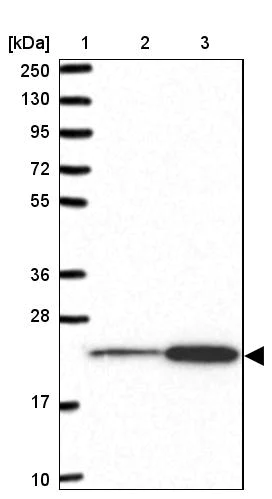 Western blot - Anti-RPL18 antibody (AB254898)