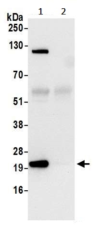 Immunoprecipitation - Anti-RPL18A antibody (AB241418)