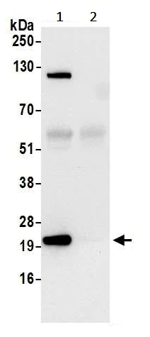 Immunoprecipitation - Anti-RPL18A antibody (AB241418)