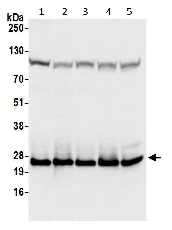 Western blot - Anti-RPL18A antibody (AB241418)