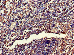Immunohistochemistry (Formalin/PFA-fixed paraffin-embedded sections) - Anti-RPL19 antibody (AB224592)