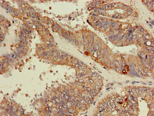 Immunohistochemistry (Formalin/PFA-fixed paraffin-embedded sections) - Anti-RPL19 antibody (AB224592)