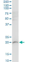 Western blot - Anti-RPL21 antibody (AB194664)