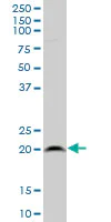 Western blot - Anti-RPL21 antibody (AB194664)