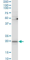 Western blot - Anti-RPL21 antibody (AB194664)