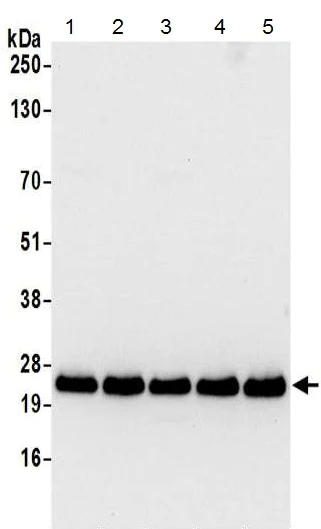 Western blot - Anti-RPL21 antibody - N-terminal (AB215724)