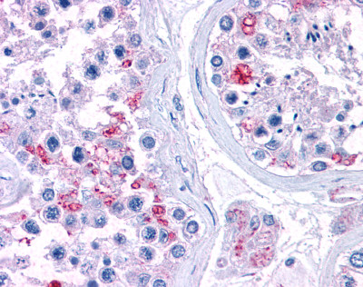 Immunohistochemistry (Formalin/PFA-fixed paraffin-embedded sections) - Anti-RPL22 antibody (AB113714)