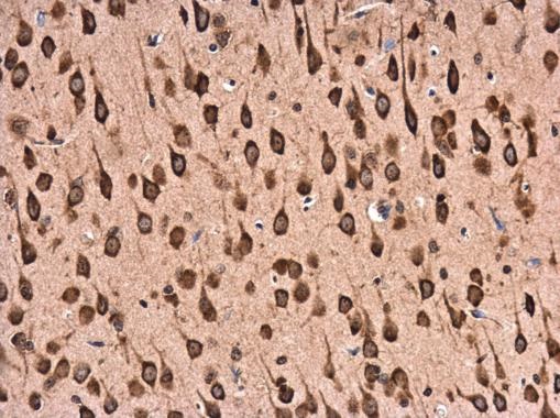 Immunohistochemistry (Formalin/PFA-fixed paraffin-embedded sections) - Anti-RPL22 antibody (AB229458)