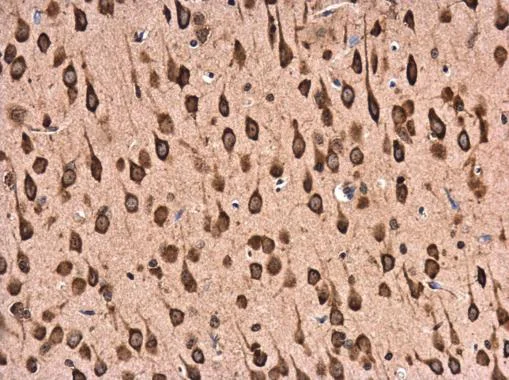 Immunohistochemistry (Formalin/PFA-fixed paraffin-embedded sections) - Anti-RPL22 antibody (AB229458)