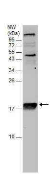 Western blot - Anti-RPL22 antibody (AB229458)