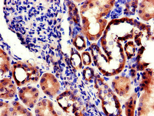 Immunohistochemistry (Formalin/PFA-fixed paraffin-embedded sections) - Anti-RPL22L1 antibody (AB234792)