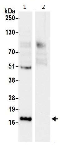 Immunoprecipitation - Anti-RPL23 antibody (AB241087), expandable thumbnail