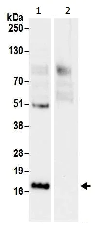 Immunoprecipitation - Anti-RPL23 antibody (AB241087)