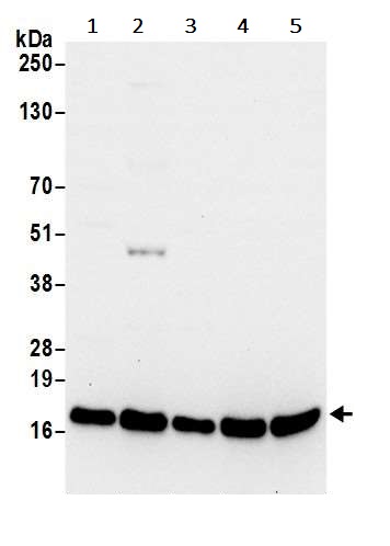 Western blot - Anti-RPL23 antibody (AB241087), expandable thumbnail