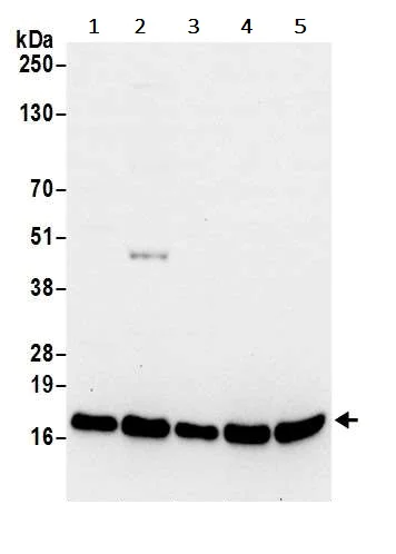 Western blot - Anti-RPL23 antibody (AB241087)