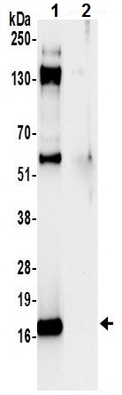 Immunoprecipitation - Anti-RPL23 antibody (AB241088)