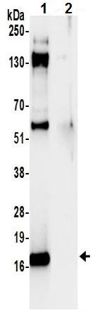 Immunoprecipitation - Anti-RPL23 antibody (AB241088)