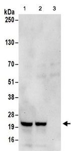 Immunoprecipitation - Anti-RPL23A antibody (AB157110)