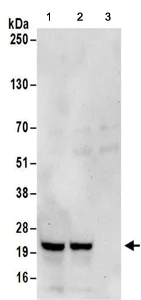 Immunoprecipitation - Anti-RPL23A antibody (AB157110)