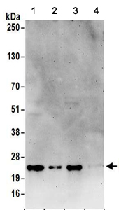 Western blot - Anti-RPL23A antibody (AB157110)