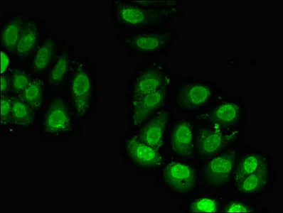 Immunocytochemistry/ Immunofluorescence - Anti-RPL23A antibody (AB223089)