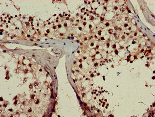 Immunohistochemistry (Formalin/PFA-fixed paraffin-embedded sections) - Anti-RPL23A antibody (AB223089), expandable thumbnail