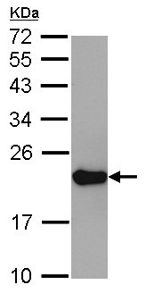 Western blot - Anti-RPL24 antibody (AB126172), expandable thumbnail