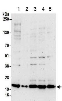 Western blot - Anti-RPL26 antibody (AB157111)