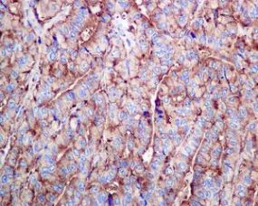 Immunohistochemistry (Formalin/PFA-fixed paraffin-embedded sections) - Anti-RPL26L1 antibody [EPR8478] (AB137046)