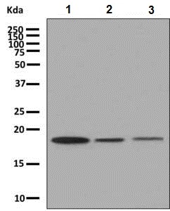Western blot - Anti-RPL26L1 antibody [EPR8478] (AB137046), expandable thumbnail