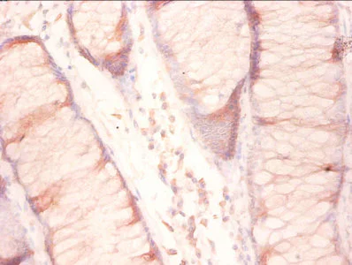 Immunohistochemistry (Formalin/PFA-fixed paraffin-embedded sections) - Anti-RPL27/RPL27A antibody (AB236906)
