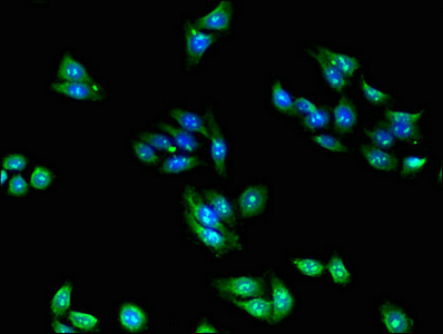 Immunocytochemistry - Anti-RPL28 antibody (AB193164)