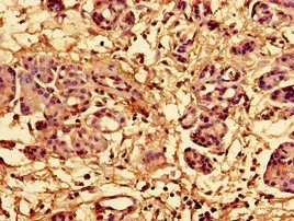 Immunohistochemistry (Formalin/PFA-fixed paraffin-embedded sections) - Anti-RPL28 antibody (AB193164)