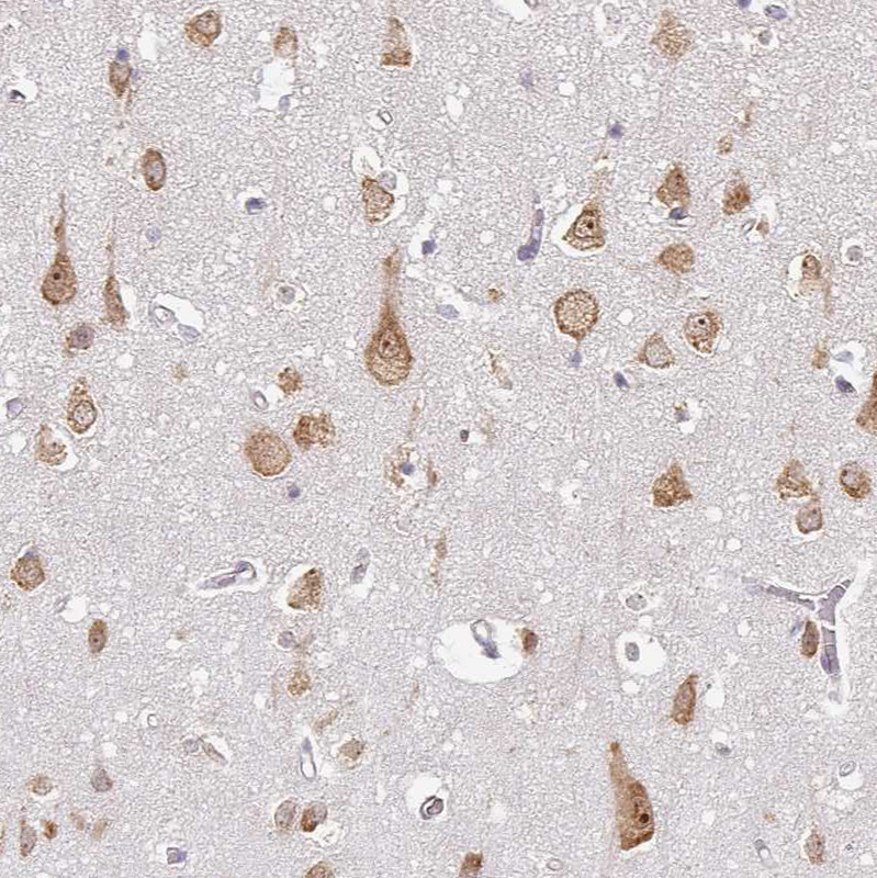 Immunohistochemistry (Formalin/PFA-fixed paraffin-embedded sections) - Anti-RPL28 antibody (AB254927)