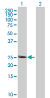 Western blot - Anti-RPL29 antibody (AB67196)