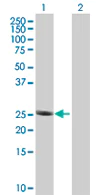 Western blot - Anti-RPL29 antibody (AB67196)