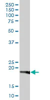 Western blot - Anti-RPL29 antibody (AB88514)