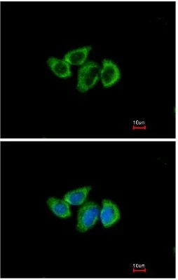 Immunocytochemistry/ Immunofluorescence - Anti-RPL3 antibody (AB154882)