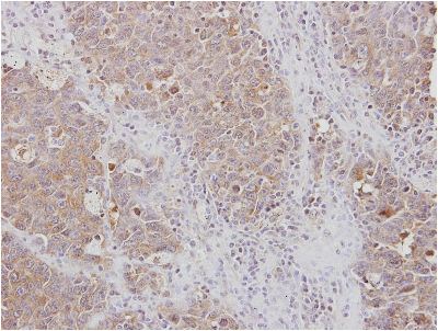 Immunohistochemistry (Formalin/PFA-fixed paraffin-embedded sections) - Anti-RPL3 antibody (AB154882), expandable thumbnail