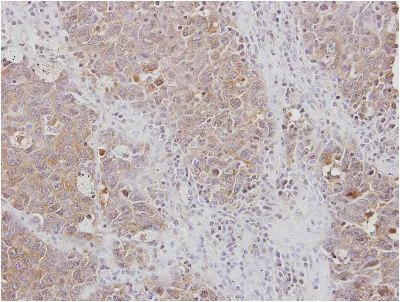 Immunohistochemistry (Formalin/PFA-fixed paraffin-embedded sections) - Anti-RPL3 antibody (AB154882)