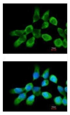 Immunocytochemistry/ Immunofluorescence - Anti-RPL3 antibody (AB228638)