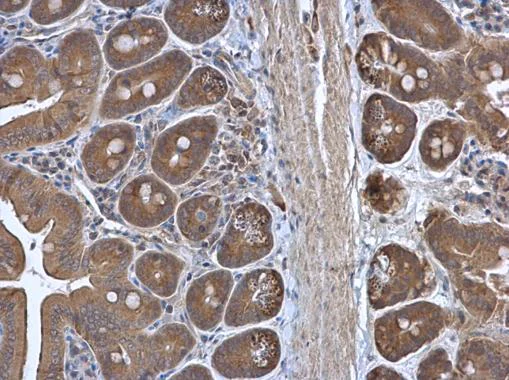 Immunohistochemistry (Formalin/PFA-fixed paraffin-embedded sections) - Anti-RPL3 antibody (AB228638)