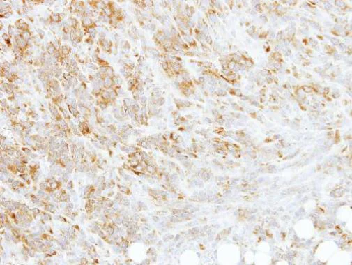 Immunohistochemistry (Formalin/PFA-fixed paraffin-embedded sections) - Anti-RPL3 antibody (AB228638)