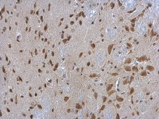 Immunohistochemistry (Formalin/PFA-fixed paraffin-embedded sections) - Anti-RPL3 antibody (AB228638)