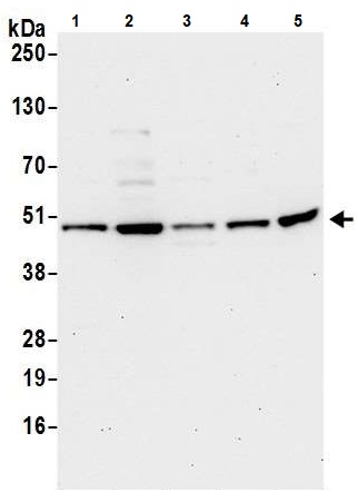 Western blot - Anti-RPL3 antibody (AB241412)